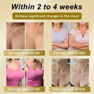 CleraLuxe® 🌞 ROYAL JELLY FIRMING & LIFT PATCH