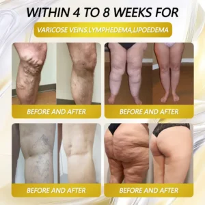 CleraLuxe® AMPK Metabolism Activating Patches – Enriched with plant extracts such as EGCG and berberine, these patches help block carbohydrate absorption and burn fat. See results in just 7 days!🎁🎁