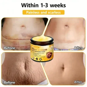 CleraLuxe® Bee Venom Skin Restoration Cream