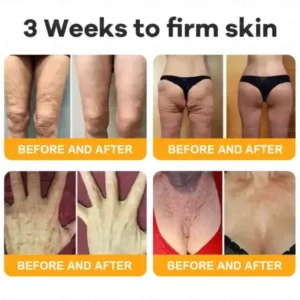 CleraLuxe® Bee Venom Skin Restoration Cream