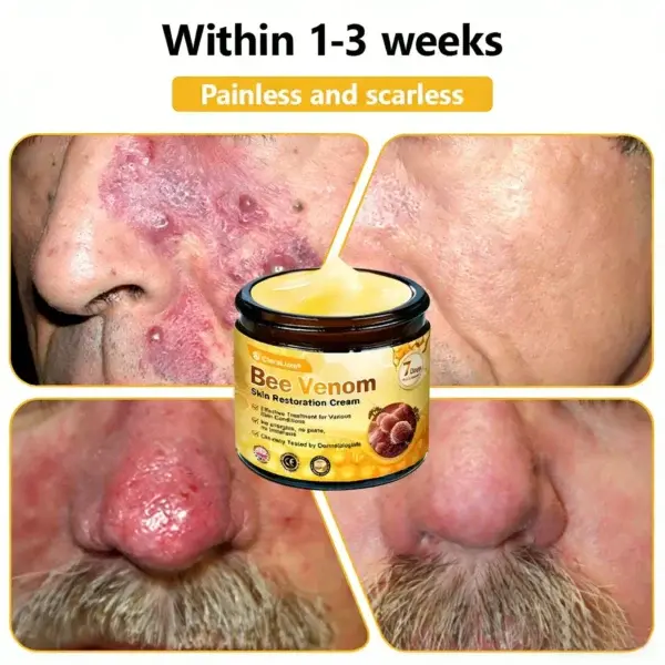 CleraLuxe® Bee Venom Skin Restoration Cream