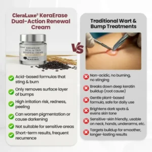 CleraLuxe® KeraErase Dual-Action Renewal Cream