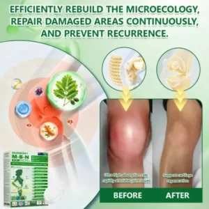 ๐ด๐ผ๐น๐พ๐ถ๐ตยฎ ๐๐ฒ๐ฟ๐ฏ๐ฒ๐ฟ๐ถ๐ป๐ฒ ๐๐-๐ข๐ง-๐ ๐ก๐ฎ๐ป๐ผ ๐ ๐ถ๐ฐ๐ฟ๐ผ๐ป๐ฒ๐ฒ๐ฑ๐น๐ฒ ๐ฃ๐ฎ๐๐ฐ๐ต