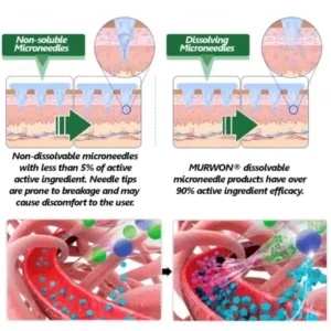 𝑴𝙐𝗥𝓦𝐎𝙉® — 𝑩𝒆𝒓𝙗𝙚𝙧𝒊𝙣𝐞 𝐀𝐝𝐯𝐚𝐧𝐜𝐞𝐝 𝙉𝙖𝙣𝙤-𝑴𝒊𝒄𝒓𝒐𝒏𝒆𝒆𝒅𝒍𝒆 𝑷𝒂𝙩𝙘𝙝 𝙏𝙚𝙘𝙝𝙣𝙤𝙡𝙤𝙜𝙮