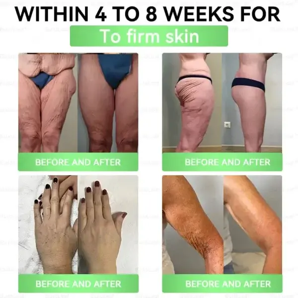 𝑩𝒖𝐢𝒍𝒅𝑳𝒆𝐚𝒇® GL𝐏-1 8-𝒊𝒏-1 𝙁𝙞𝙩 & 𝙑𝙞𝙩𝙖𝙡 𝖮𝗋𝖺𝗅 𝙎𝙤𝙡𝙪𝙩𝙞𝙤𝙣