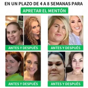 RISARISA® 𝐏𝐚𝐫𝐜𝐡𝐞 𝐝𝐞 𝐌𝐢𝐜𝐫𝐨𝐚𝐠𝐮𝐣𝐚𝐬 𝐍𝐚𝐧𝐨 𝐝𝐞 𝐍𝐀𝐃+ 𝐲 𝐁𝐞𝐫𝐛𝐞𝐫𝐢𝐧𝐚 – 𝐑𝐞𝐦𝐨𝐝𝐞𝐥𝐚𝐜𝐢ó𝐧 𝐂𝐨𝐫𝐩𝐨𝐫𝐚𝐥