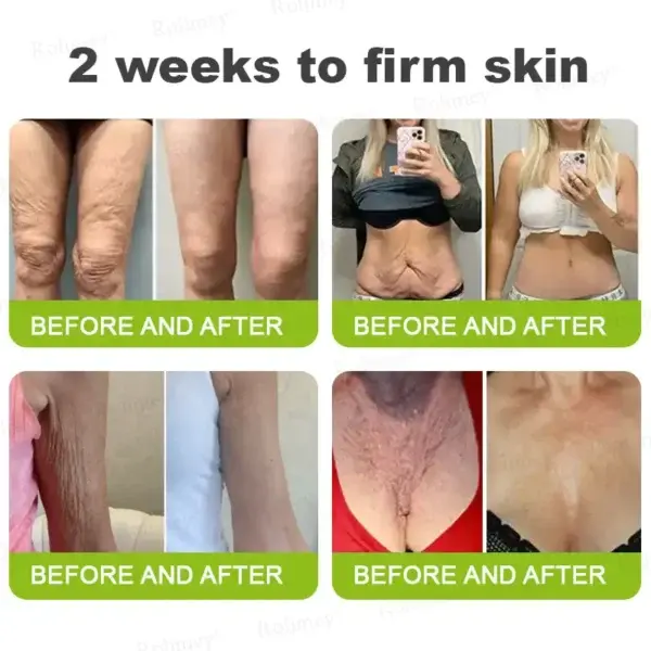 Rolimey® Botox & Vita-A Retinol Shot Tightening and Wrinkle-Reducing Cream